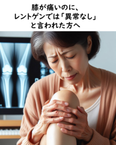 膝が痛いのに、レントゲンでは「異常なし」と言われた方へ｜霧島市の永峯整骨院。隼人･国分からすぐ